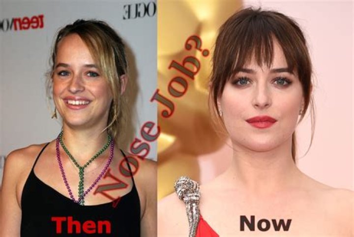 Did Dakota Johnson Do Face Lift? Plastic Surgery Claims In SNL!