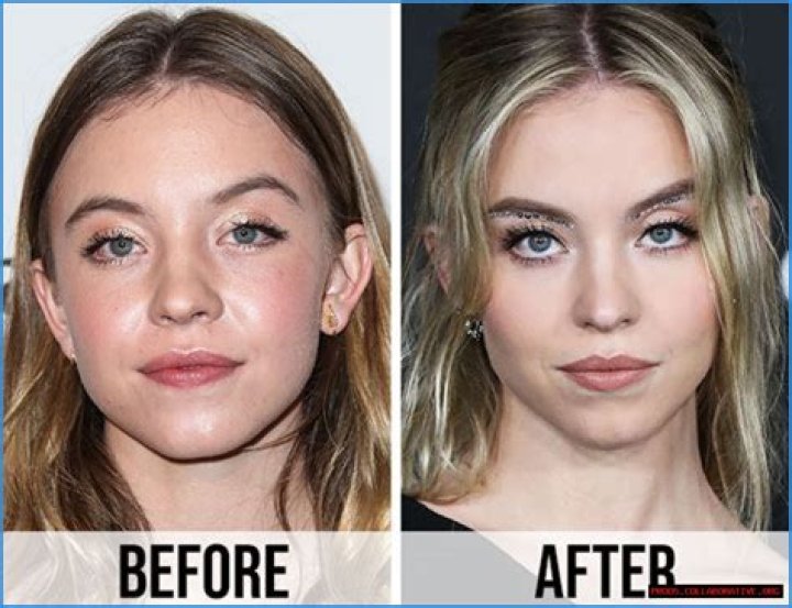 Sydney Sweeney Weight Loss Before And After