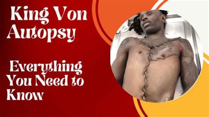 Unseen Details And Expert Analysis Of King Von's Autopsy Photo